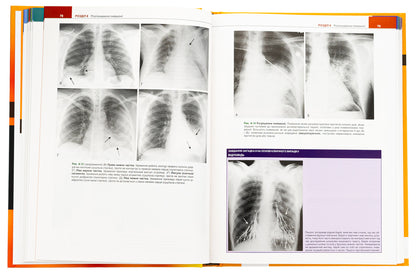 Study of radiology. Basics of visualization / Вивчення радіології. Основи візуалізації Уильям Херринг 978-617-505-971-5-6