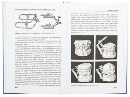 The technique of manufacturing removable prostheses / Техніка виготовлення знімних протезів Татьяна Банных, Петр Флис 978-617-505-963-0-6
