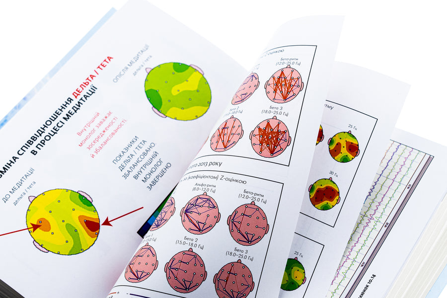 You are your own placebo. Turn your mind into medicine / Ти сам собі плацебо. Перетвори свій розум на ліки Джо Диспенза 978-617-548-264-3-4