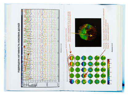 You are your own placebo. Turn your mind into medicine / Ти сам собі плацебо. Перетвори свій розум на ліки Джо Диспенза 978-617-548-264-3-5